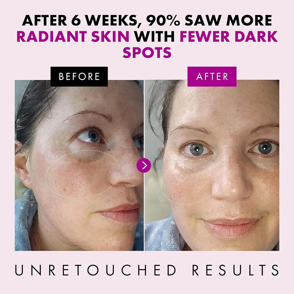 Crema facial de colágeno de 50g que nutre la piel regordeta, crema de textura fresca para hacer la piel más joven crema hidratante de día/noche Cosméticos Coreanos