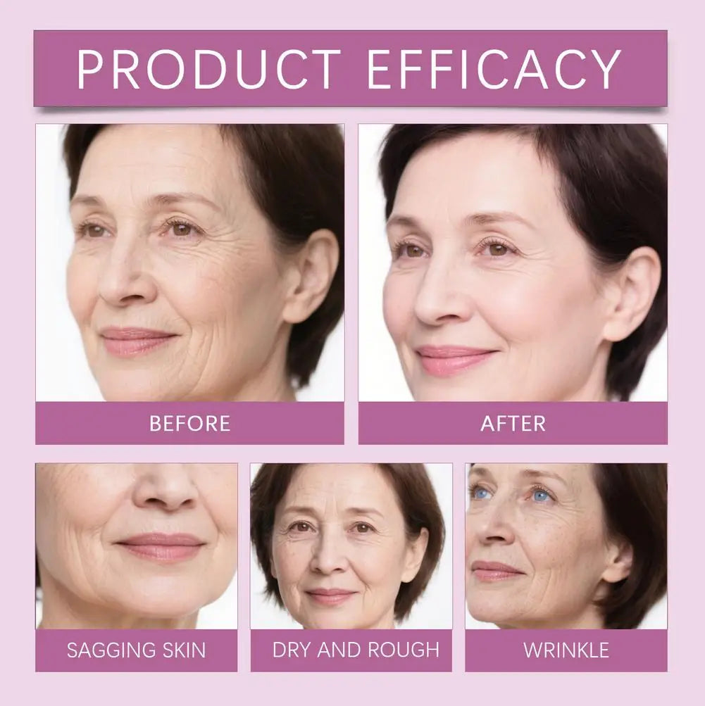 Bálsamo múltiple de calcio antienvejecimiento, volumen reafirmante hidratante, reparación de sequedad calmante, ilumina el tono de la piel, crema hidratante profunda en barra